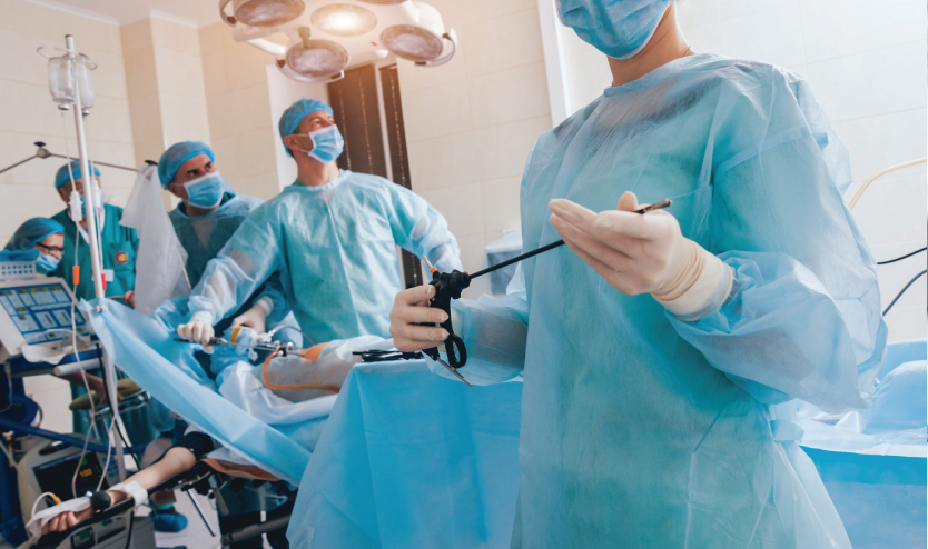 Laparoscopy